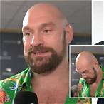 bet on tyson fury